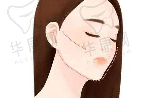 与青岛诺德医学美容医院马昕医生的术前沟通