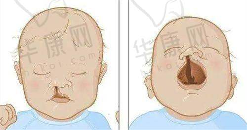 合肥艺星假体隆胸价格贵吗?