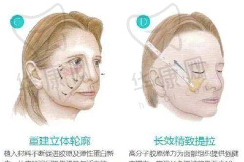 术后修复与护理