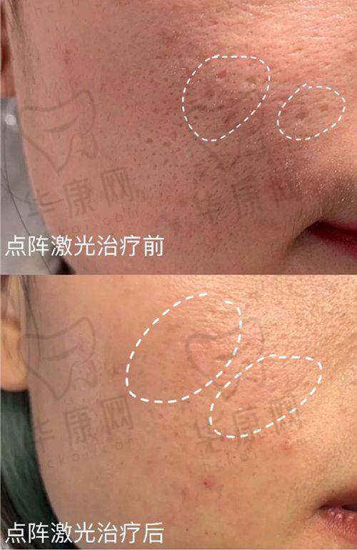 合肥艺星隆鼻收费情况如何?