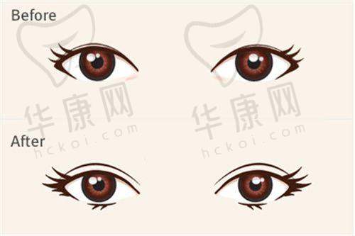 石家庄美莱医学美容医院石亮医生擅长项目