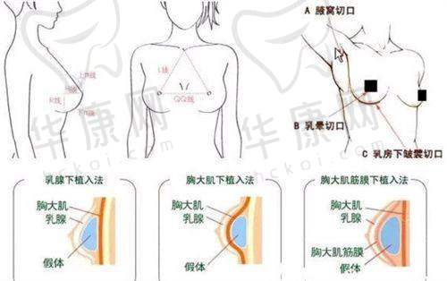 热拉提做一次对轻度和中度松弛的成效有何不同?
