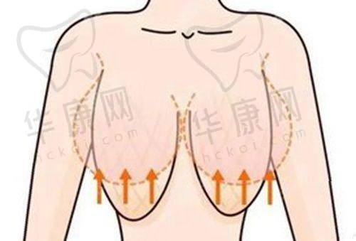 王志军 医生在SMAS除皱术上有哪些创新?