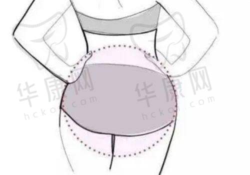 价格透明：成都军大整形外科医院的手术费用