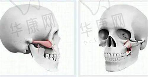 3D生物束带缩阴能否维持五年以上