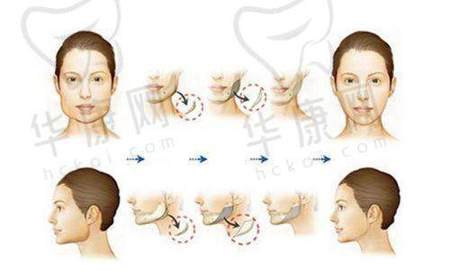 冯安明医生特色技术优势