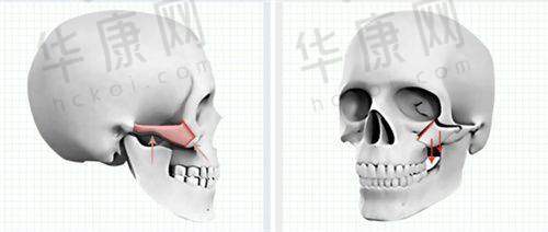 深圳国有医院整形科有哪些特色技术?
