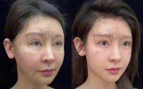 广州祛疤效果好的医院排行榜：曙光、复星禅诚等正规医院疤痕修复成效佳