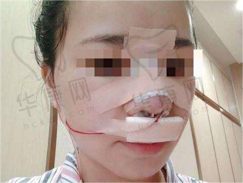 华美整形美容医院在线电话常见问题解答