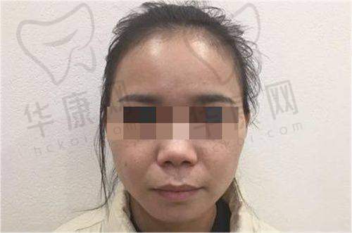 石家庄美莱医学美容医院石亮医生预约方式