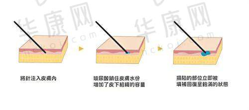 专精检测与方案制定