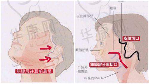 术前检查与准备