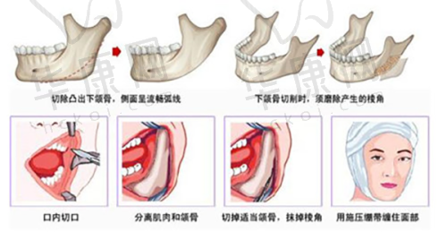 6. 成都军大整形医院