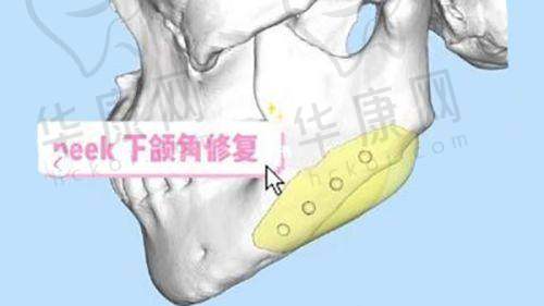 重庆松山整形医院正规认证