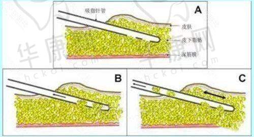 华美整形美容医院价目表2025背后的技术实力如何？