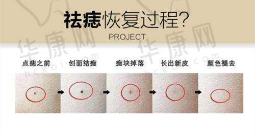 攀枝花市中医和西医结合医院整形美容科,祛疤成效好吗?