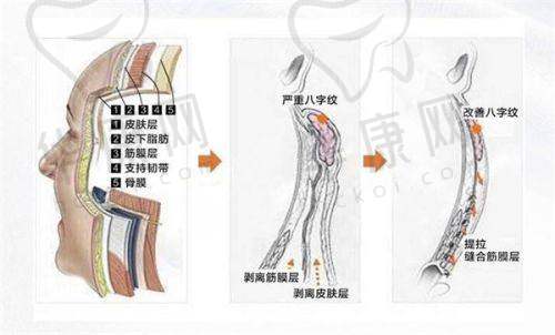 深圳张辉做鼻子,技术特色有哪些?