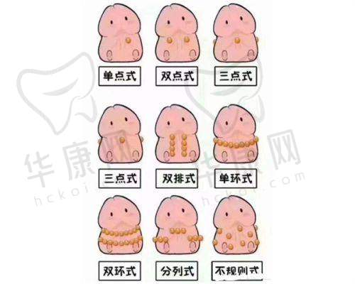 总结
