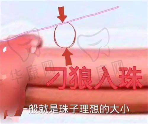 昆明韩辰整形医院价格表如何?——价格清晰明了