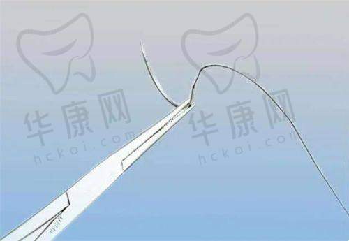 王召东医生做拉皮手术有哪些技术优势？