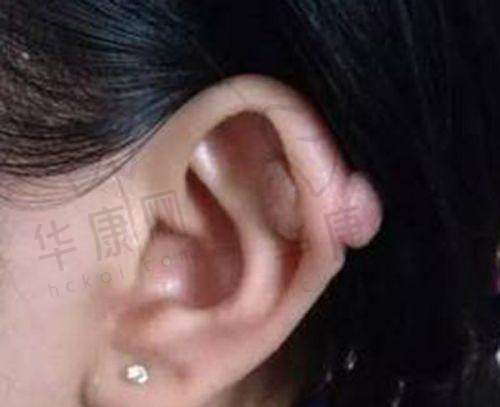 广州私立整形医院中与国内外接轨的是哪家?——广州美莱医疗美容医院