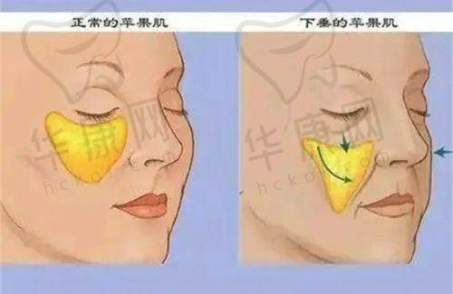 9. 成都新丽美整形