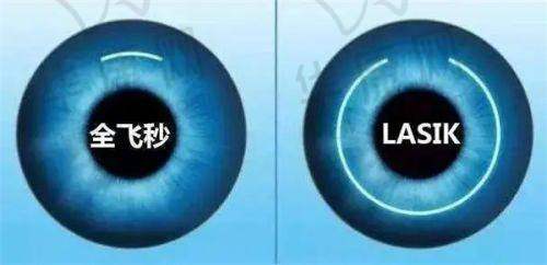 国内做后巩膜加固术的医生排名情况如何？北京上海等地医生优势及收费参考一览