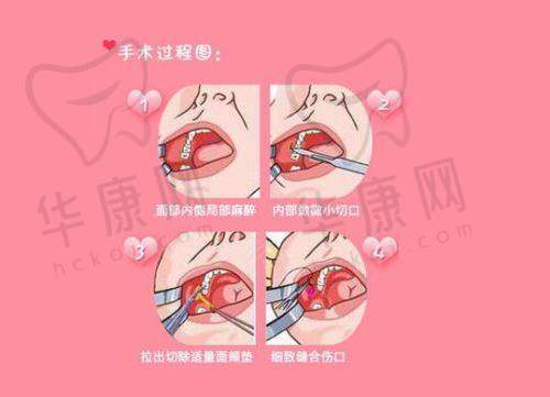 河南中医药大学第一附属医院美容科如何预约挂号?就诊流程是怎样的?