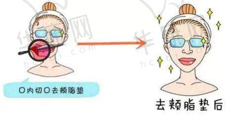 深圳张辉做鼻子,顾客口碑如何?