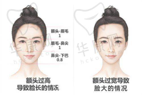 不同情况下3D生物束带缩阴的维持时长