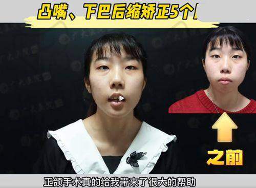 卜双燕医生审美怎么样？独特理念与丰富经验打造自然美观且契合气质的玻尿酸美容疗效