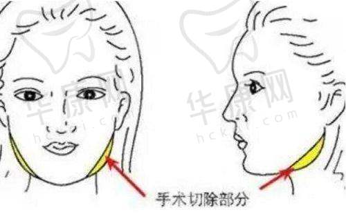 广州广大整形医院
