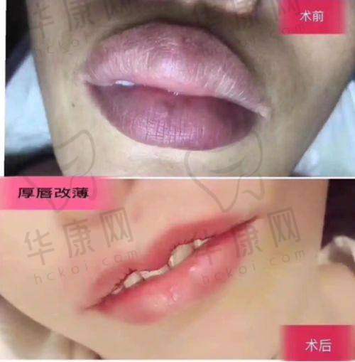 西安晶肤医美医生团队专精