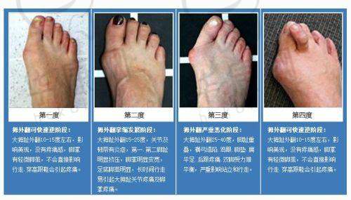 显著的诊疗成效