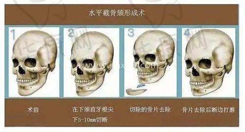 广州医美俪整形医院
