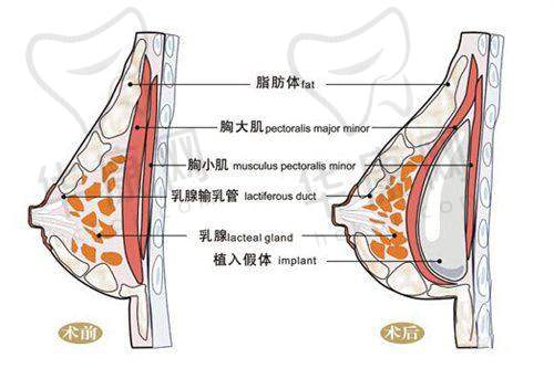 深圳美莱医疗美容医院梁晓健医生的口碑评价