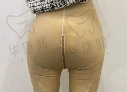 选择北京伊思凯丽的纠结与值得