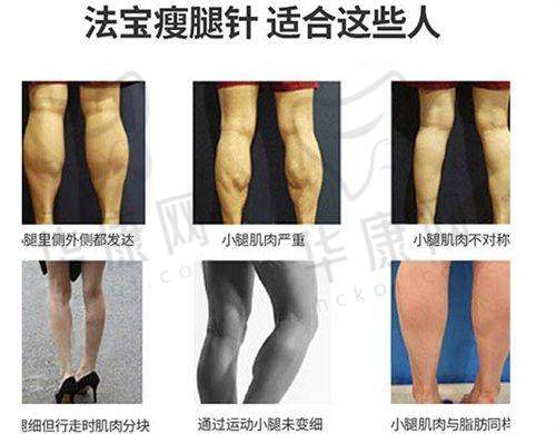 手术过程：轻松与安心同在