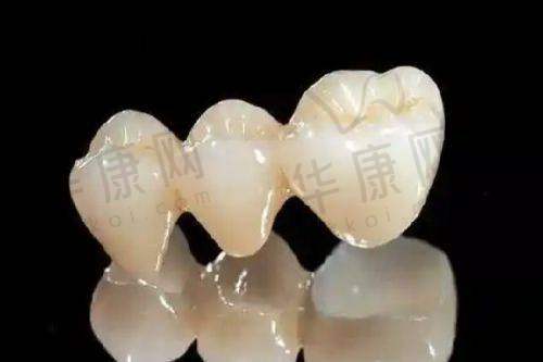 庆阳优齿泰数字口腔医院医疗保险使用的优势