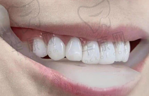 总结：值得信赖的口腔医疗选择