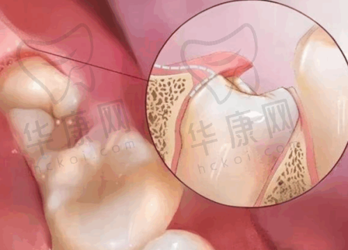 深圳穗华口腔医院怎么样？收费标准、地址电话全揭晓，还有特色技术与专家介绍