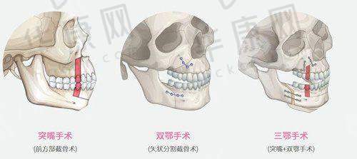 南通俪人连天美医疗美容医院赵其中医生的口碑评价
