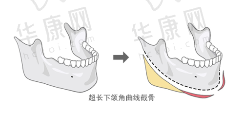 独特的治疗方案