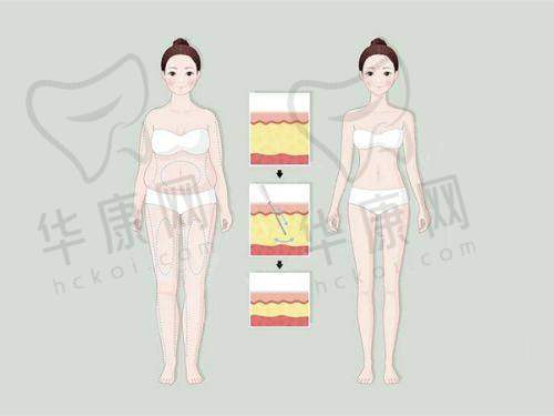高性价比的选择