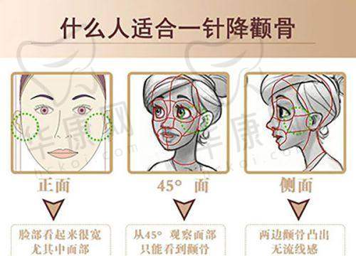 深圳美莱医疗美容医院徐占锋特色技术优势