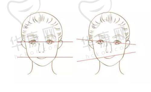 武汉真爱妇产医院龚美云处女膜修复的成功实例