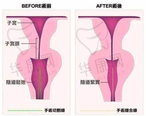 重庆万州华美紫馨整形美容医院刘天云医生的口碑评价
