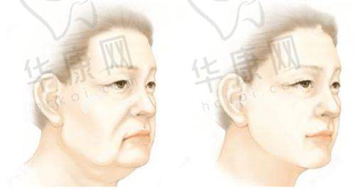 郑行跃医生精细诊断