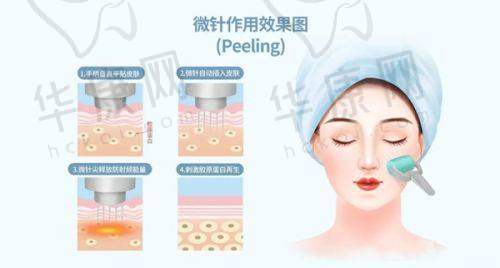 广州荔医医疗美容门诊部成功实例分享