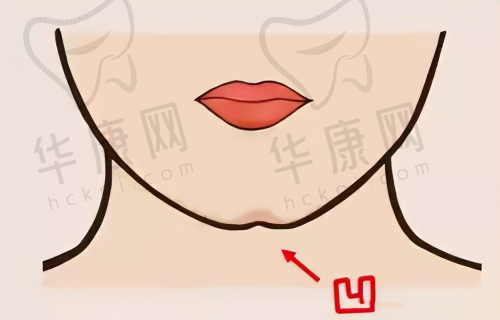 手术方案确定与术前检查